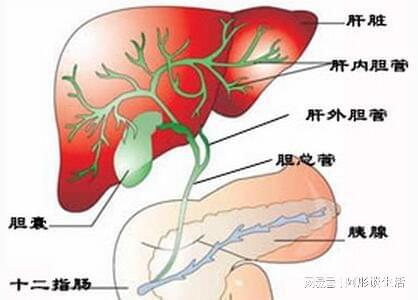 胆结石吃什么中药能化掉