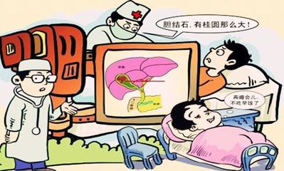 什么是胆结石?造成原因有?该如何处理?术后如何保养?