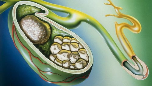 咖啡因是有益健康,还是对健康不利 医生告诉你真相