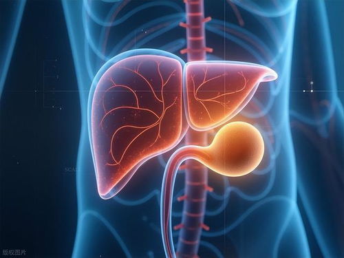 胆结石不疼就没事 医生提醒 3 个症状别忽视,拖成癌就晚了